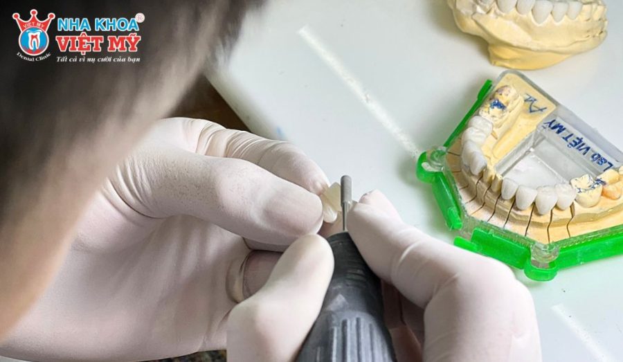 Trang thiết bị hiện đại, đạt chuẩn được Nha khoa Việt Mỹ đầu tư chỉn chu