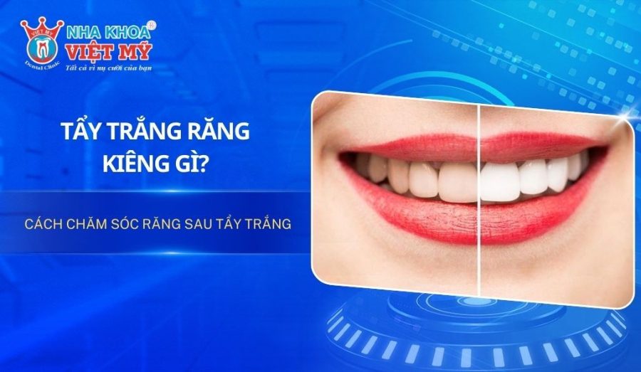 Tẩy trắng răng kiêng gì? Cách chăm sóc răng sau tẩy trắng