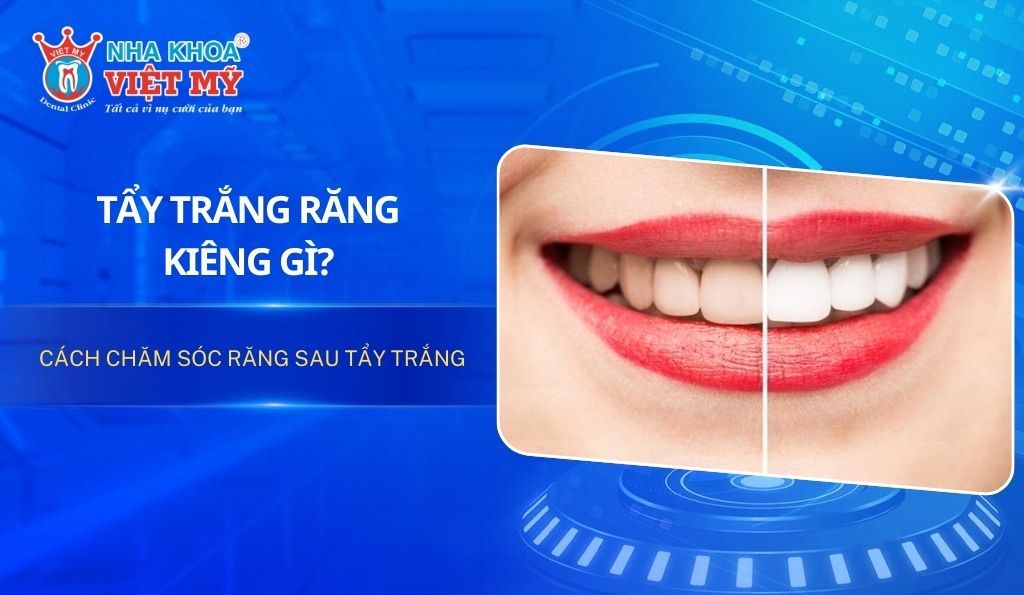 Tẩy trắng răng kiêng gì? Cách chăm sóc răng sau tẩy trắng