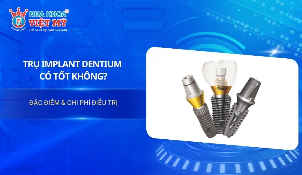 Trụ Implant Dentium có tốt không? Đặc điểm & chi phí điều trị