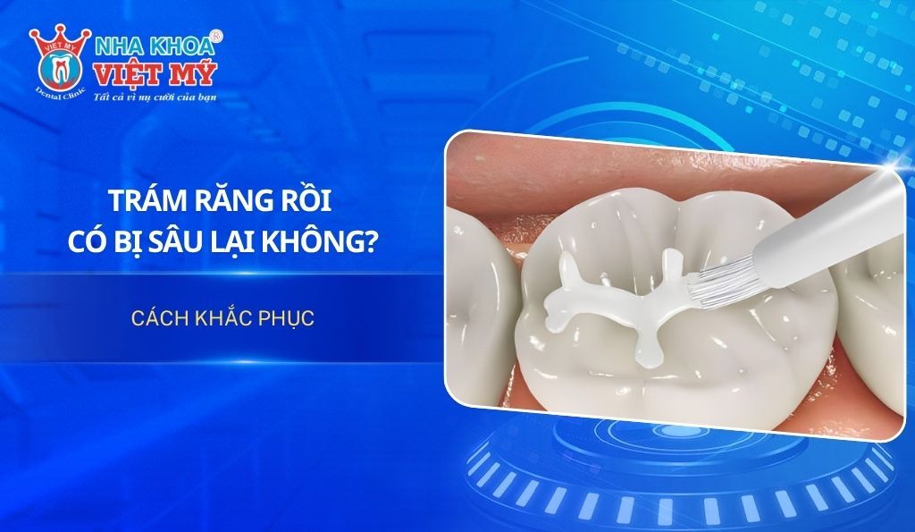 Giải đáp: Trám răng rồi có bị sâu lại không? Cách khắc phục