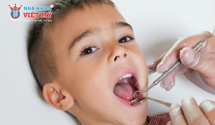 Các biện pháp giải quyết khi trẻ bị gãy răng sữa