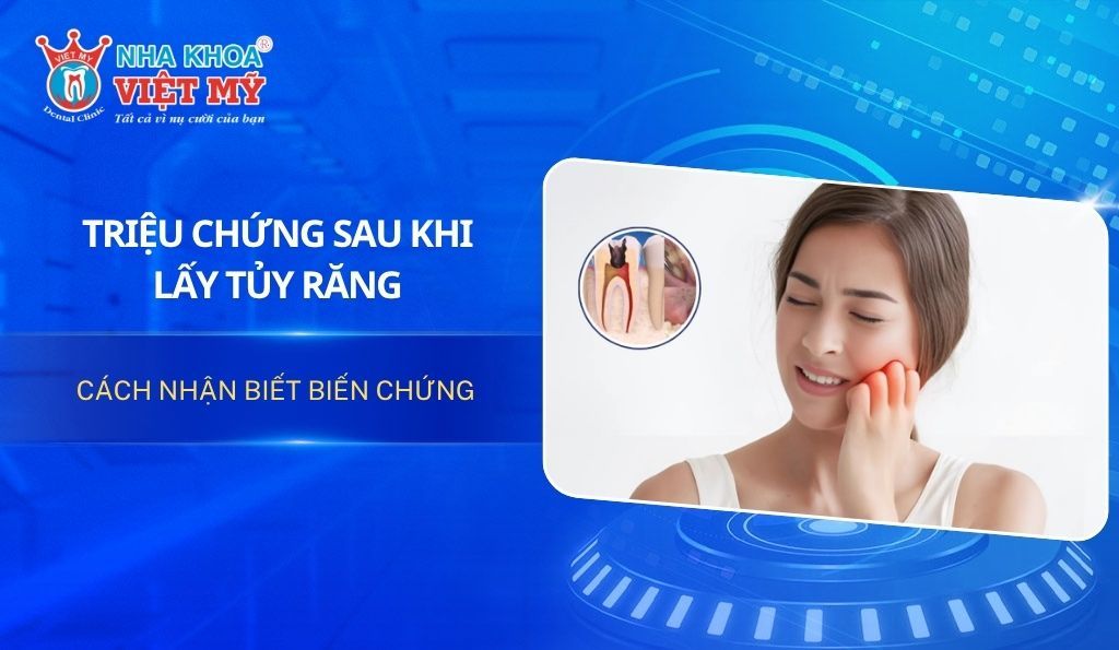 Triệu chứng sau khi lấy tủy răng: Cách nhận biết biến chứng