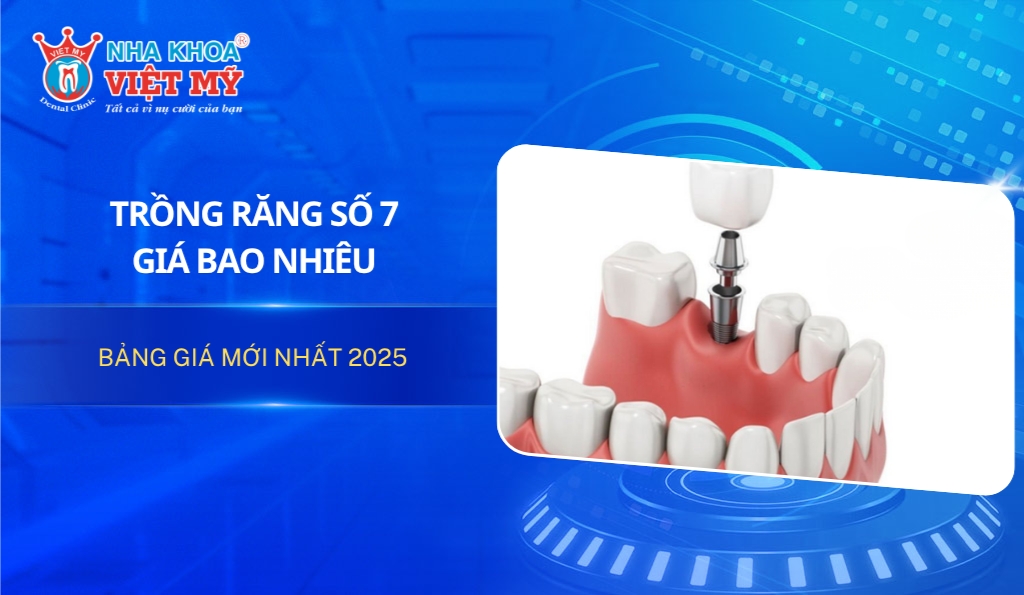 Trồng răng số 7 giá bao nhiêu?
