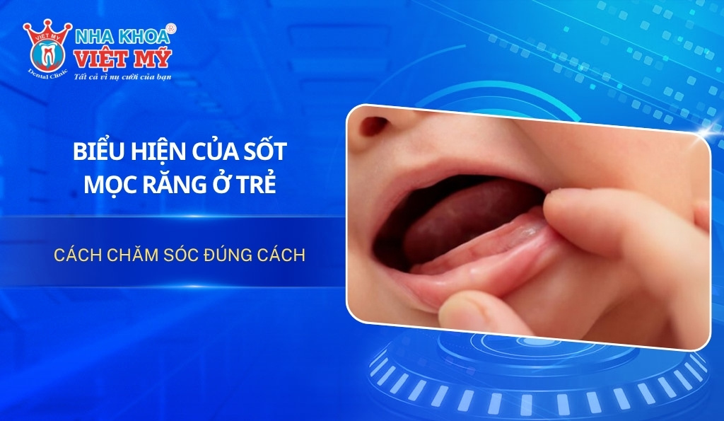 Biểu hiện của sốt mọc răng ở trẻ