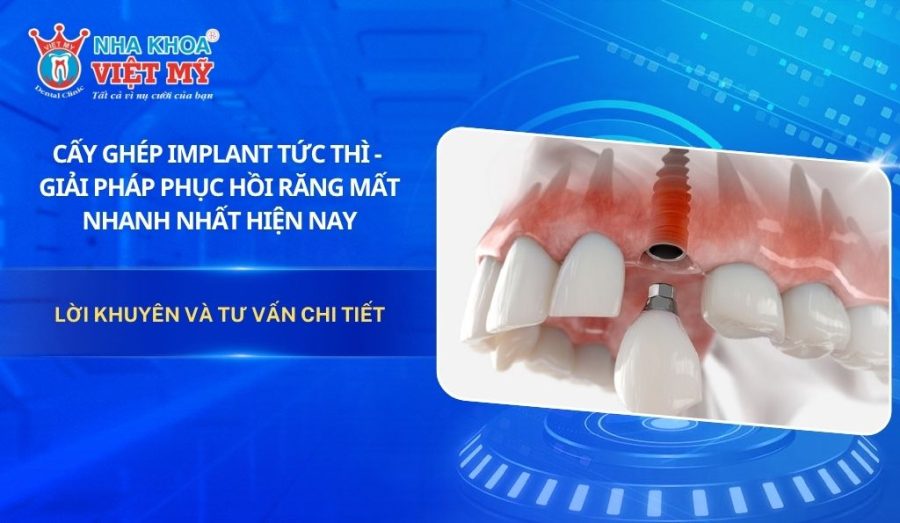 Cấy ghép Implant tức thì – Giải pháp phục hồi răng mất nhanh nhất hiện nay
