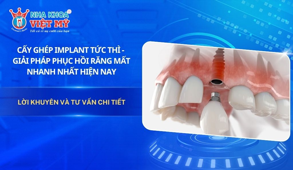 Cấy ghép Implant tức thì – Giải pháp phục hồi răng mất nhanh nhất hiện nay