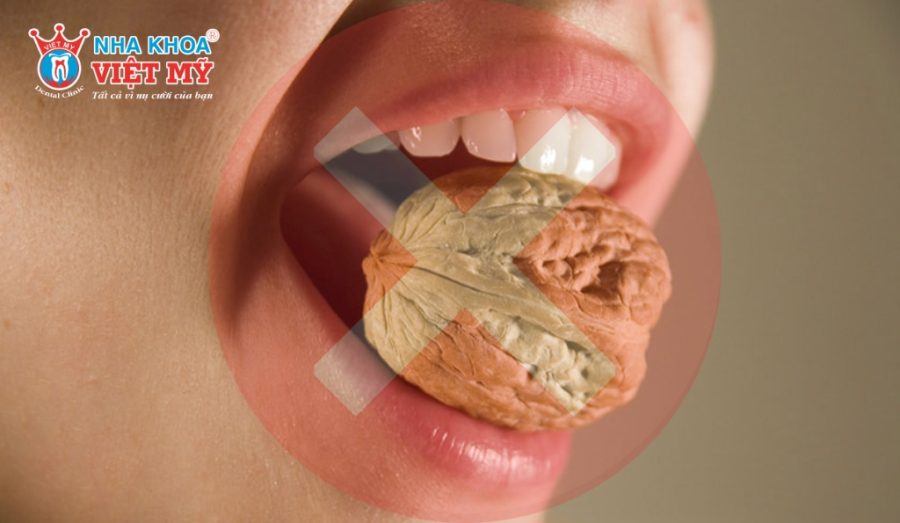 Sau khi nhổ răng khôn mọc lệch hàm trên không nên ăn thức ăn cứng vì dễ làm tổn thương vùng nhổ răng