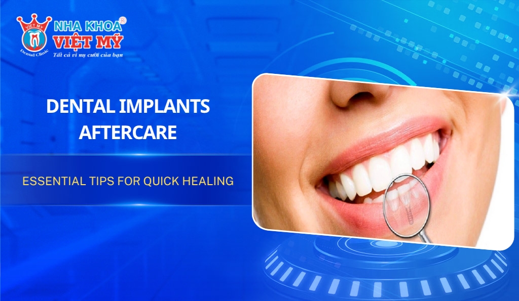 Dental Implants Aftercare - Essential Tips for Quick Healing