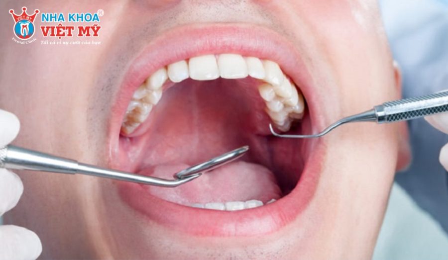 Dental examination, illustrating procedures like bone grafting that affect total cost