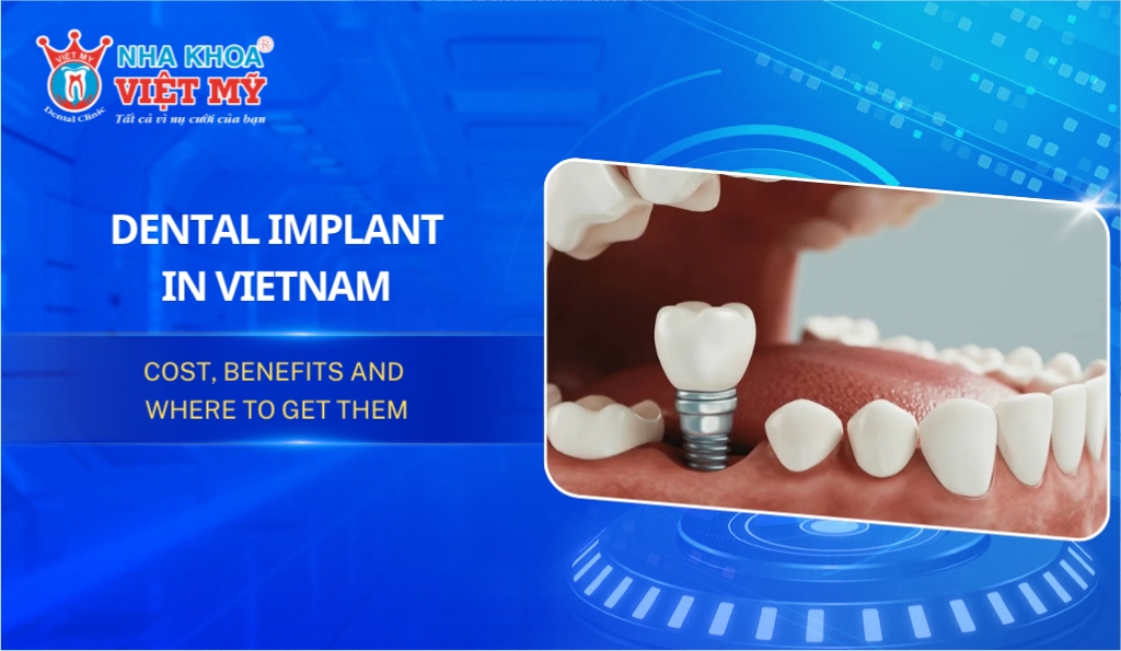 Dental Implant in Vietnam