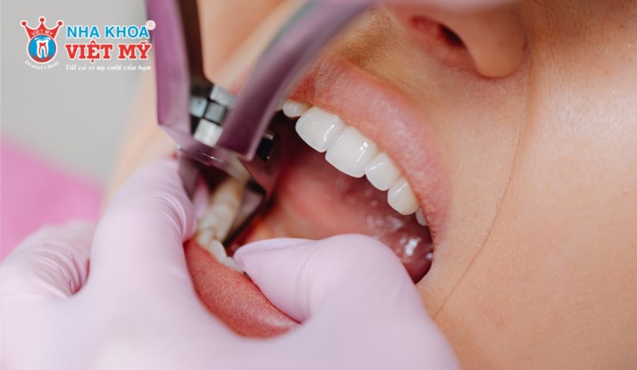 If a tooth is damaged, it will need to be extracted before placing the implant