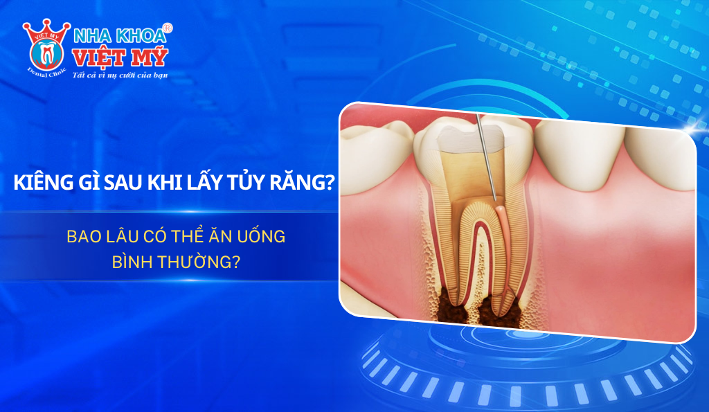 Kiêng gì sau khi lấy tủy răng?