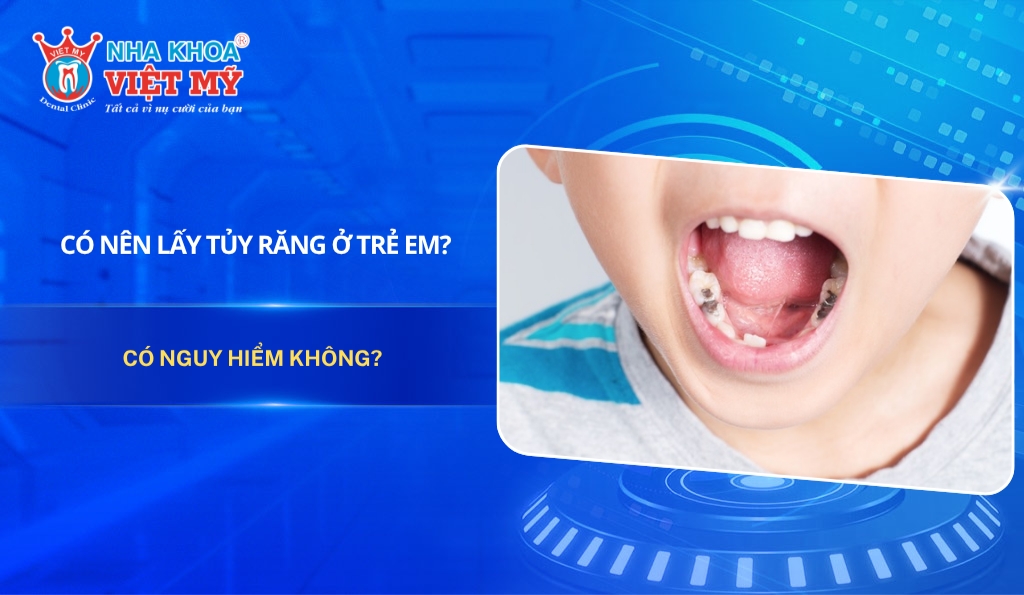 Có nên lấy tủy răng ở trẻ em? Có nguy hiểm không?