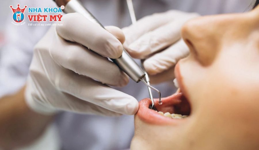 Chi phí mài xương ổ răng dao động tùy theo tình trạng của từng người