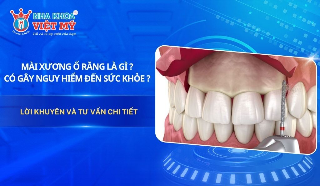 Mài xương ổ răng là gì? Có gây nguy hiểm đến sức khỏe?