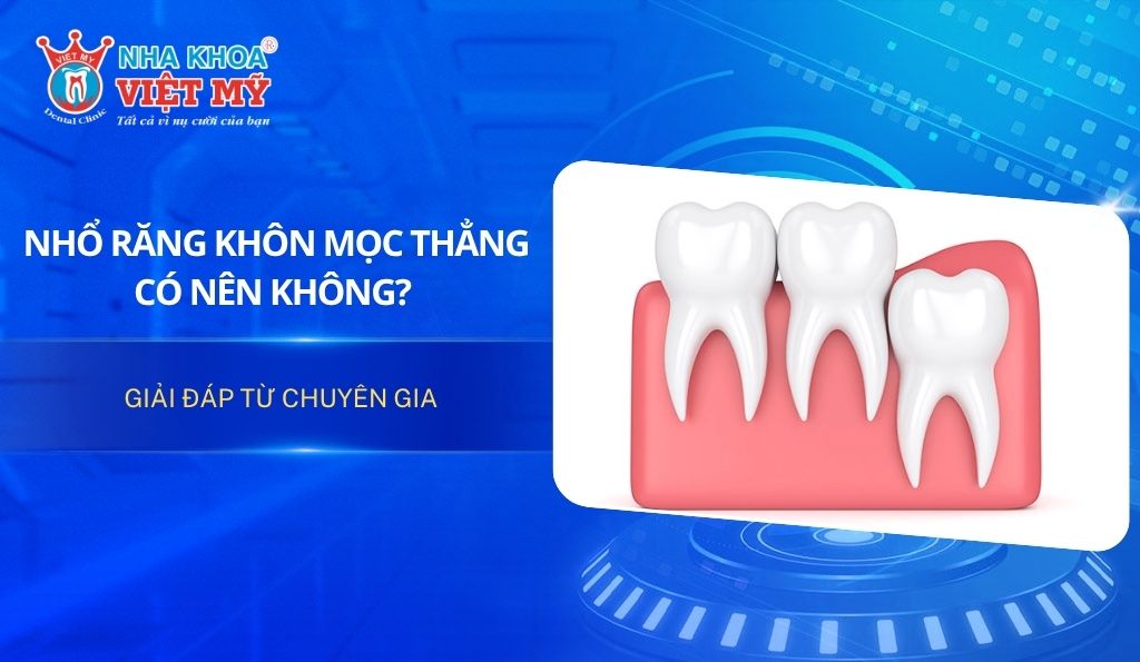 Nhổ răng khôn mọc thẳng có nên không? Giải đáp từ chuyên gia
