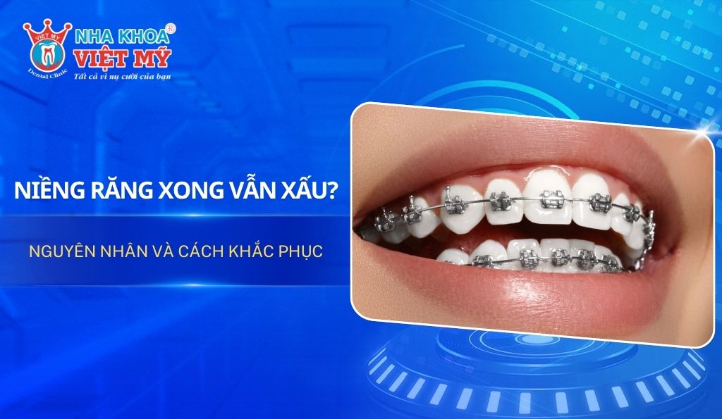Niềng răng xong vẫn xấu? Nguyên nhân và cách khắc phục