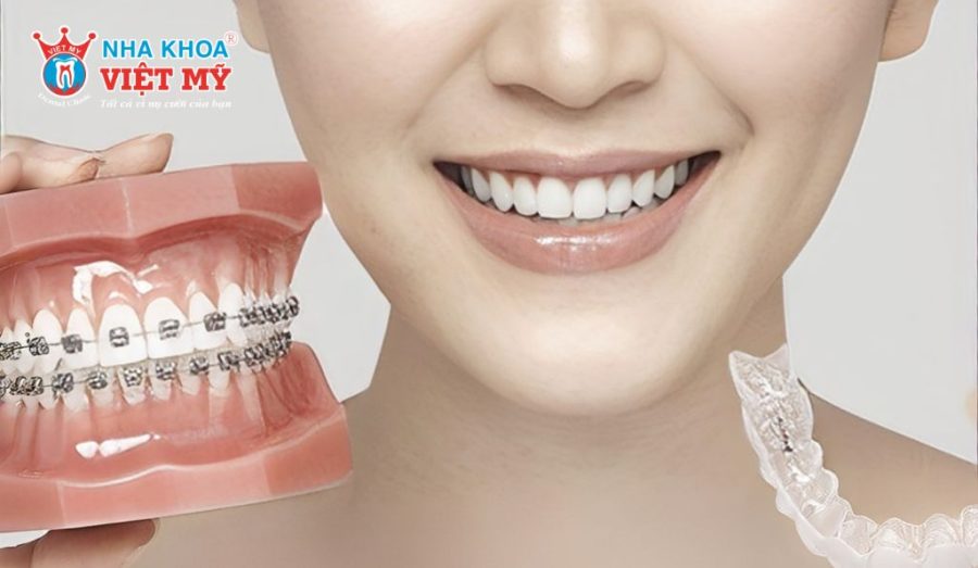 Các hướng xử lý cho răng chưa đạt thẩm mỹ sau niềng