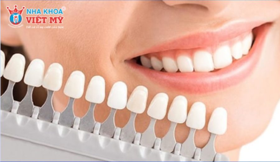 Zirconia và các loại phôi sứ khác về thẩm mỹ và độ bền