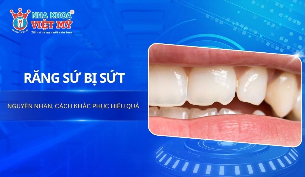 Răng sứ bị sứt: Nguyên nhân, cách khắc phục hiệu quả