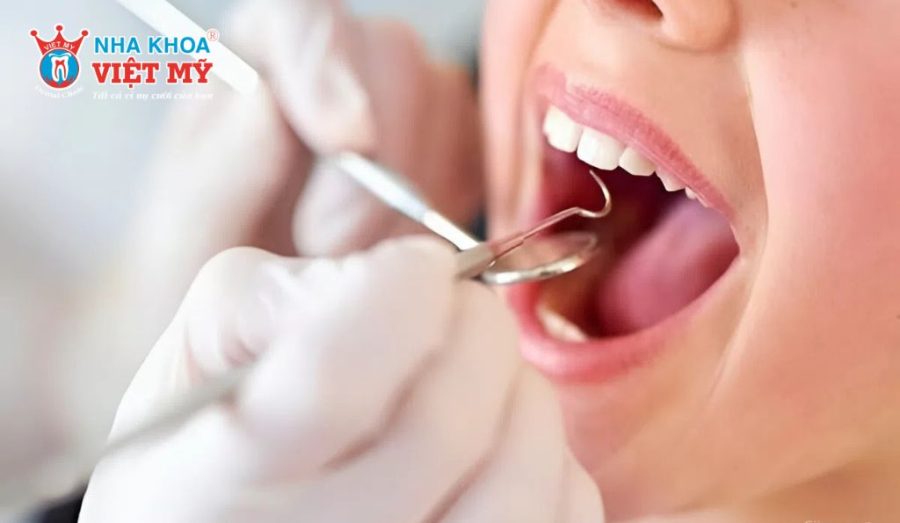 Cần đặt thuốc diệt tủy từ 2 đến 3 lần để tủy răng chết hoàn toàn