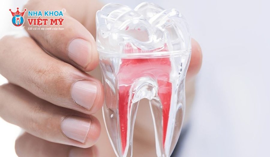 4 lưu ý sau khi đặt thuốc diệt tủy để đảm bảo an toàn