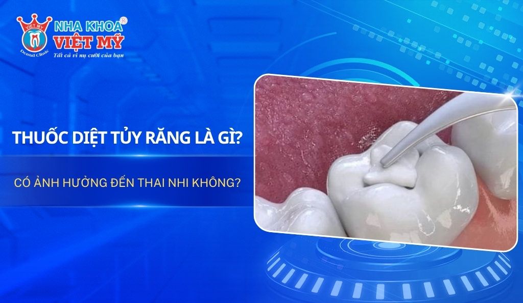 Thuốc diệt tủy răng là gì? Có ảnh hưởng đến thai nhi không?