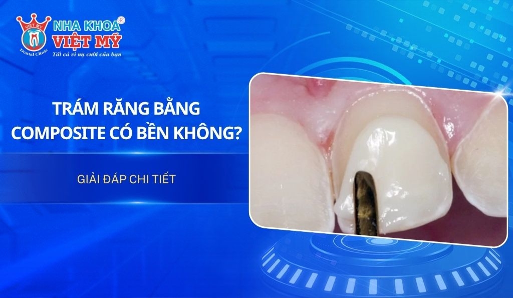 Trám răng bằng Composite có bền không?
