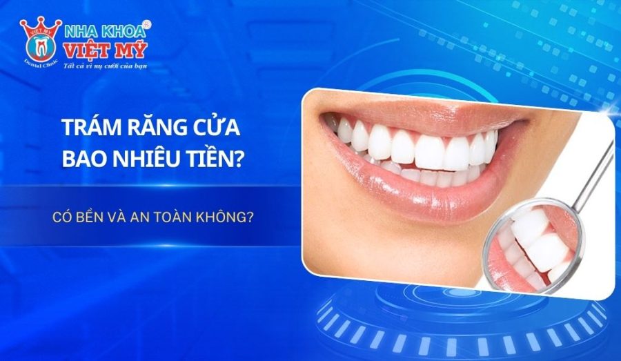 Trám răng cửa bao nhiêu tiền? Có bền và an toàn không?