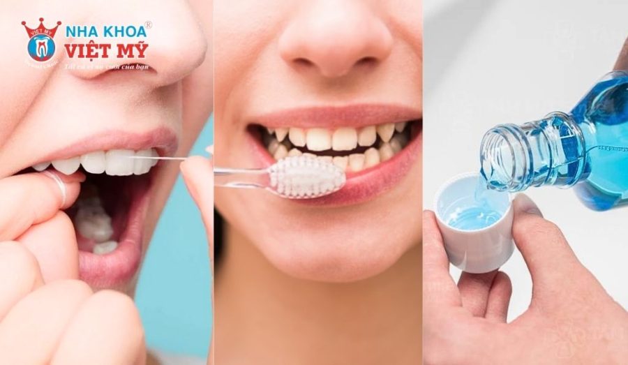 Cách duy trì độ bền và thẩm mỹ sau khi trám răng Inlay/Onlay