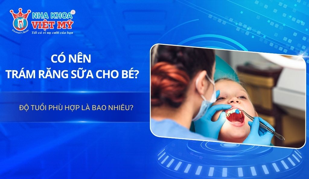 Có nên trám răng sữa cho bé? Độ tuổi phù hợp là bao nhiêu?