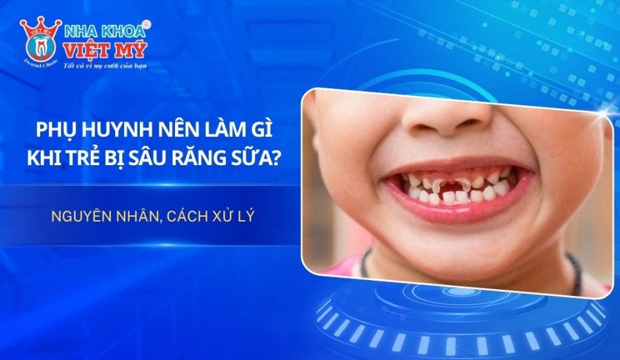 Phụ huynh nên làm gì khi trẻ bị sâu răng sữa?