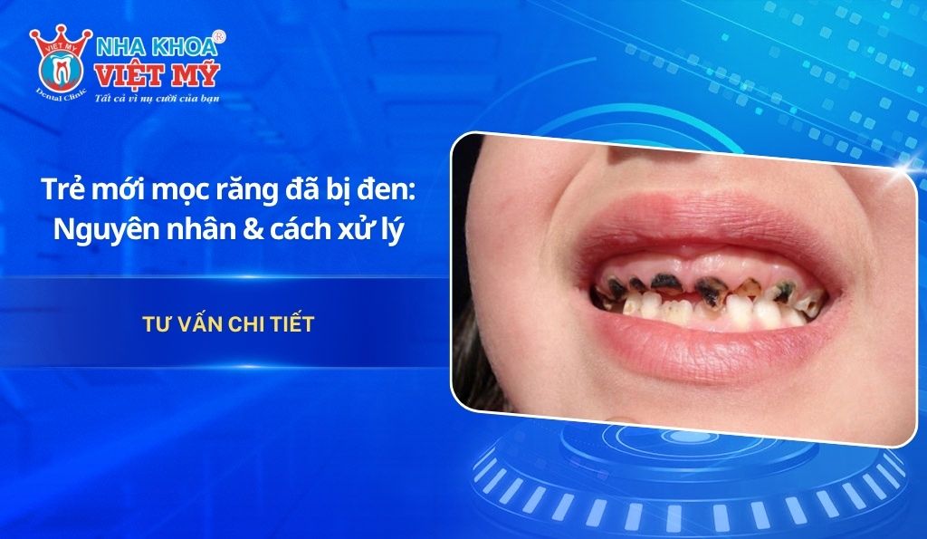 Trẻ mới mọc răng đã bị đen: Nguyên nhân & cách xử lý