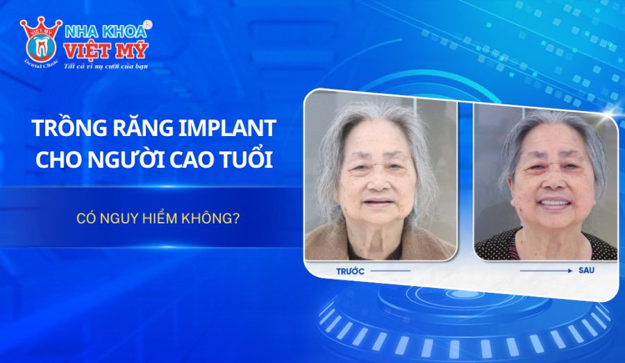 Trồng răng Implant cho người cao tuổi có nguy hiểm không?