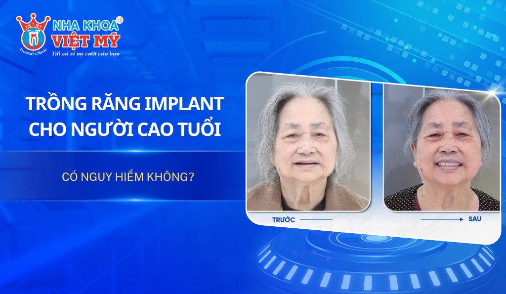 Trồng răng Implant cho người cao tuổi có nguy hiểm không?