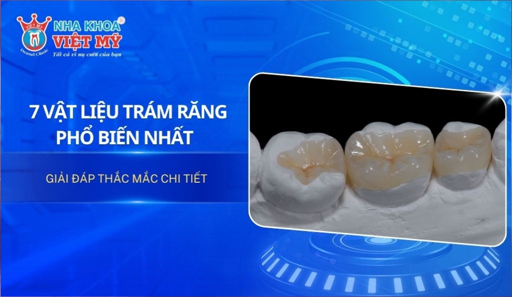 7 vật liệu trám răng phổ biến và được tin dùng nhất hiện nay