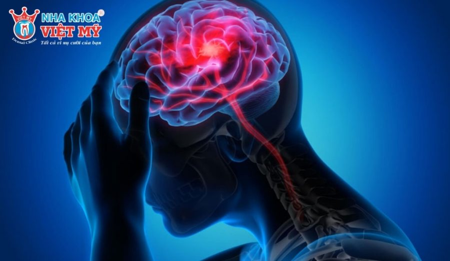 Đau nhói tận óc, đau giật theo nhịp tim - biểu hiện điển hình của viêm tủy cấp tính