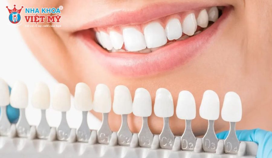 Bảng màu phôi sứ HT Smile với 16 tông màu từ tự nhiên đến trắng sáng