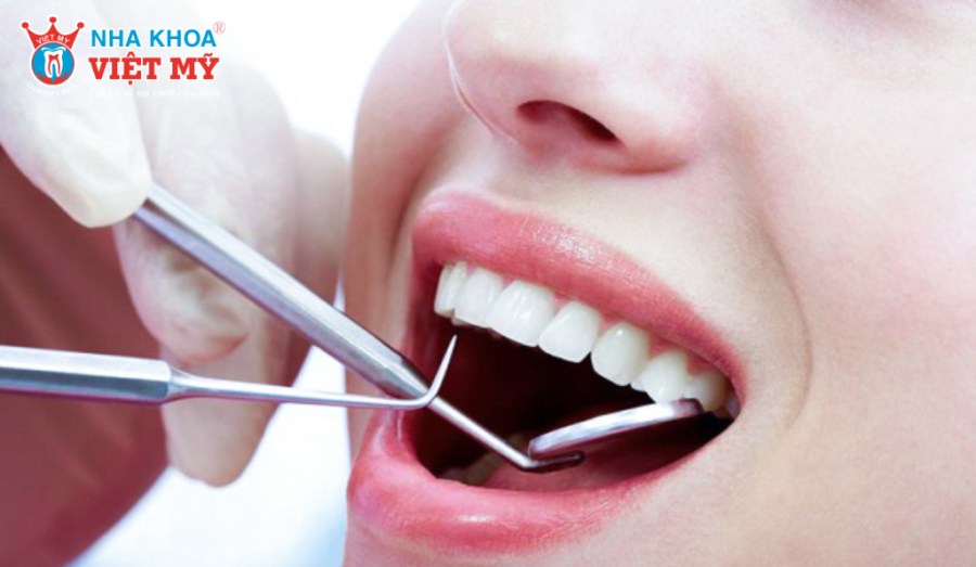 Hướng dẫn chăm sóc răng miệng và tái khám định kỳ sau khi bọc sứ Emax