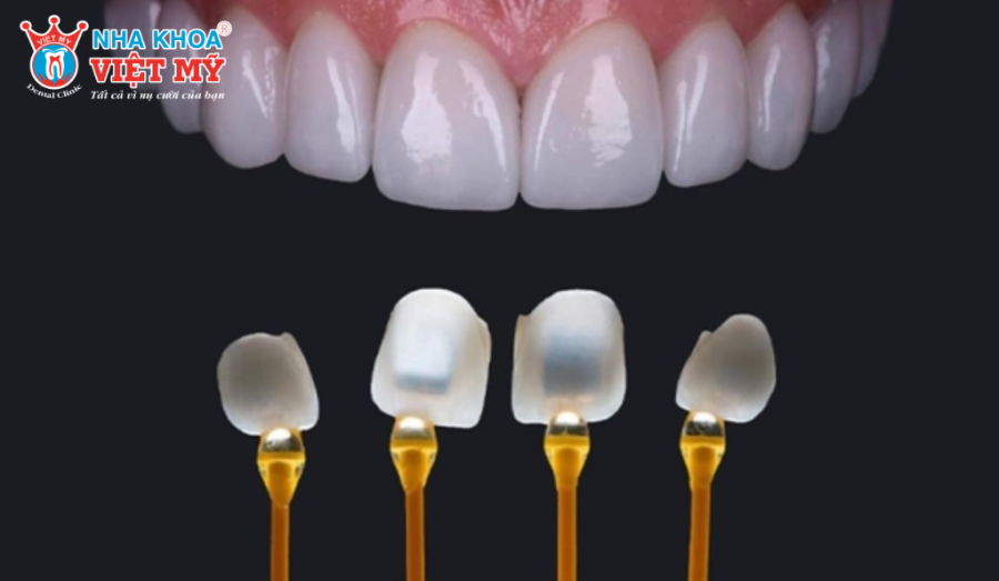 Răng sứ Emax được làm từ vật liệu thủy tinh Lithium Disilicate, có độ bền và tính thẩm mỹ cao