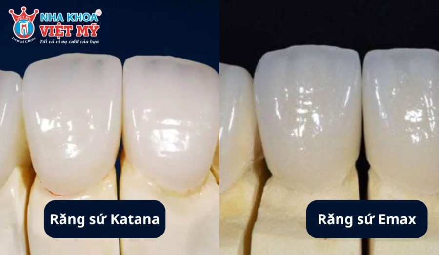 So sánh răng sứ Katana và răng sứ Emax
