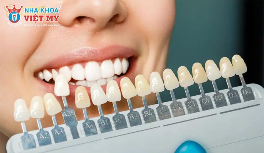 Bảng màu răng toàn sứ Katana