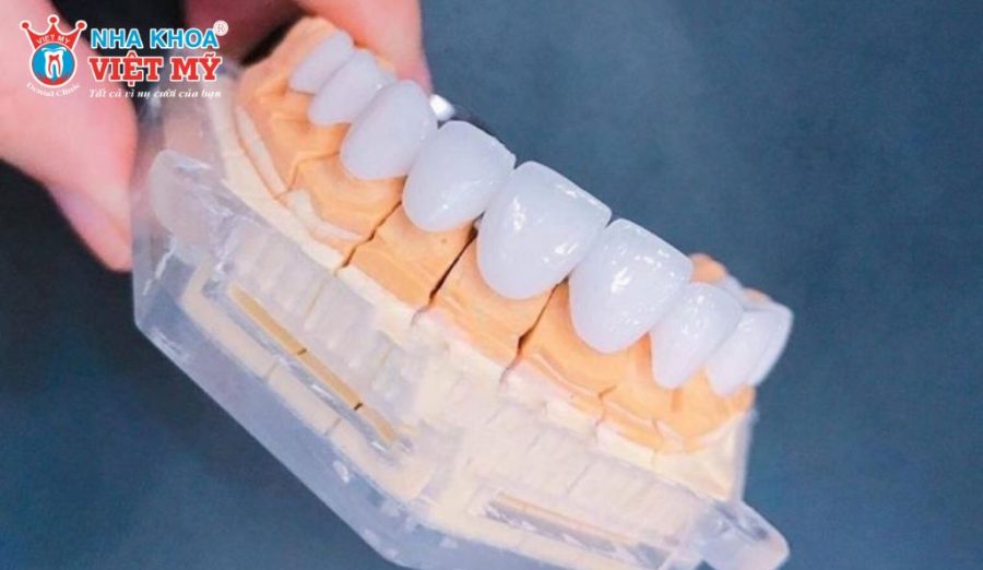 Răng sứ Orodent được nhiều người lựa chọn để khắc phục những nhược điểm của răng