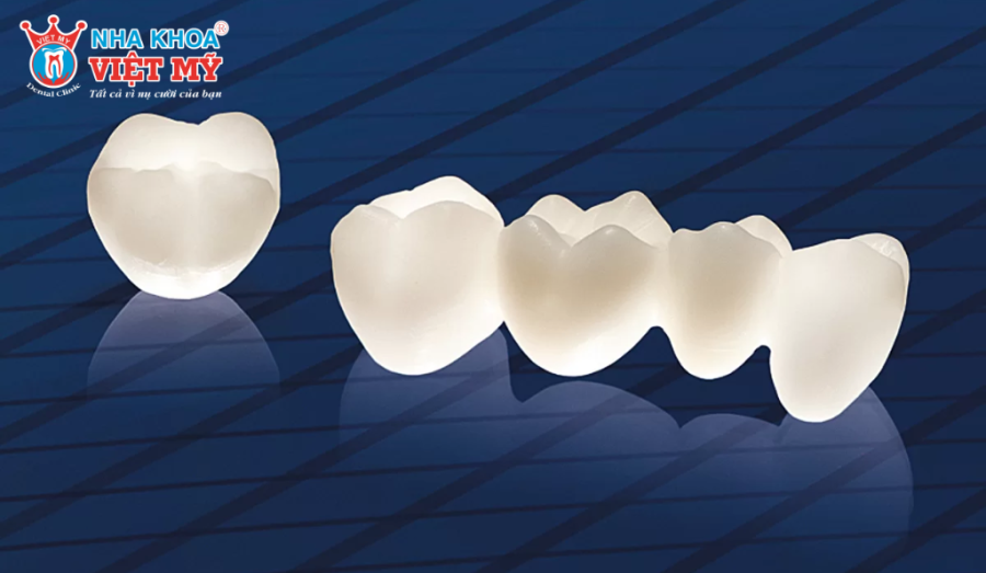 Răng sứ Venus được nhiều khách hàng lựa chọn và có độ bền cực tốt