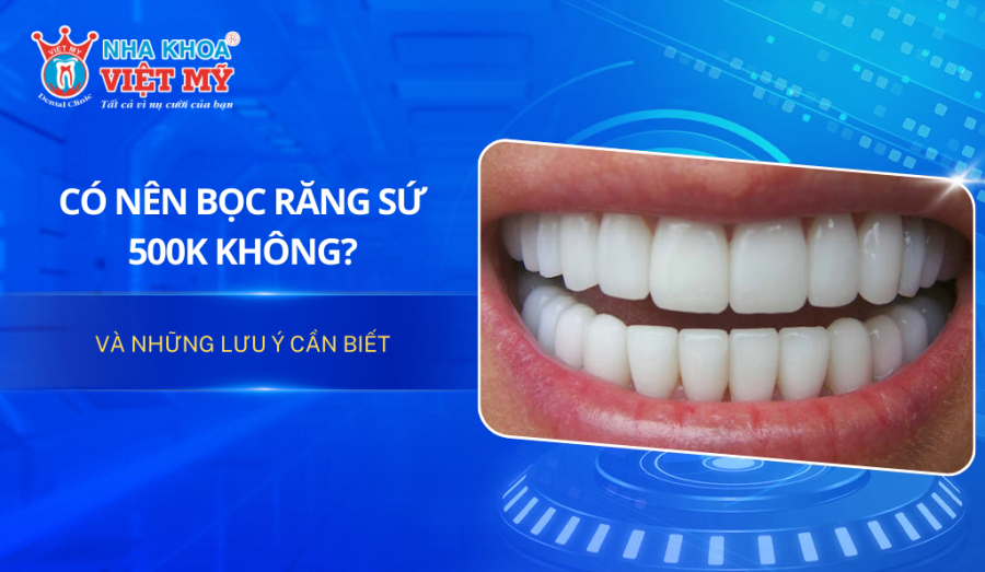 Có nên bọc răng sứ 500k không và những rủi ro cần biết