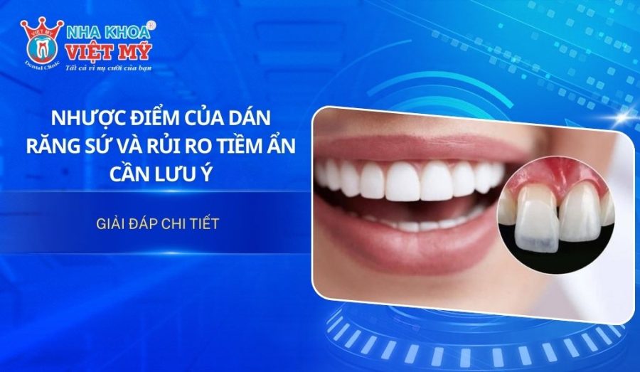 Nhược điểm của dán răng sứ và rủi ro tiềm ẩn cần lưu ý