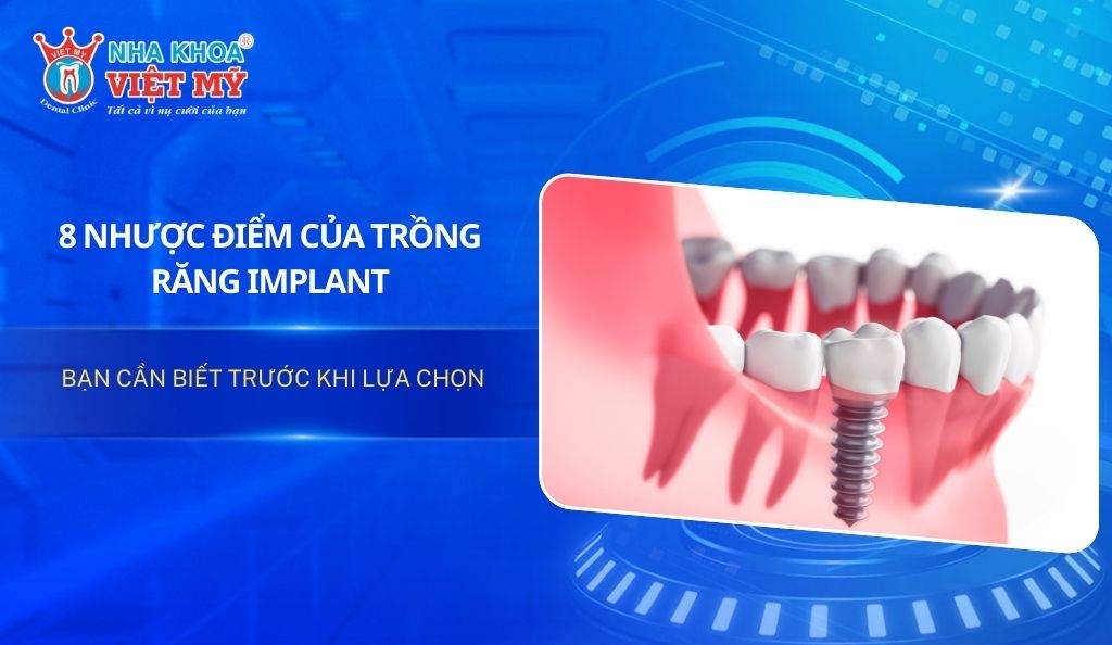 8 Nhược điểm của trồng răng Implant bạn cần biết trước khi lựa chọn
