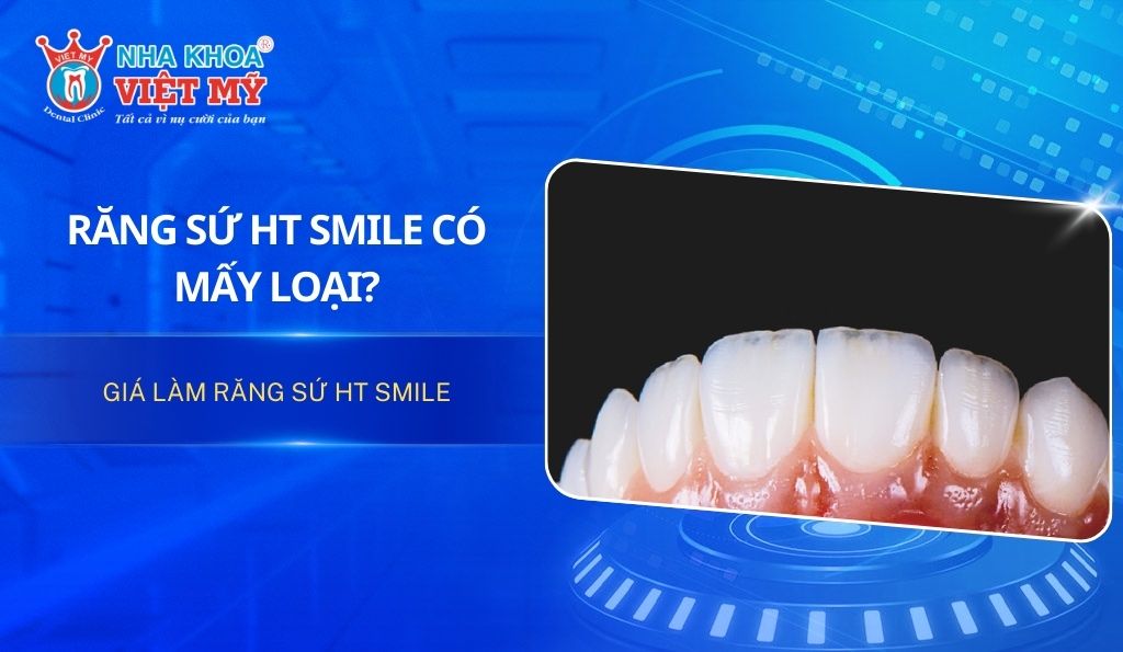 Răng sứ HT Smile có mấy loại và giá bao nhiêu tiền?