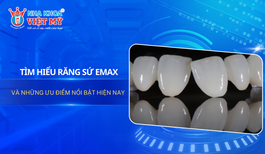 Tìm hiểu răng sứ Emax và những ưu điểm nổi bật hiện nay